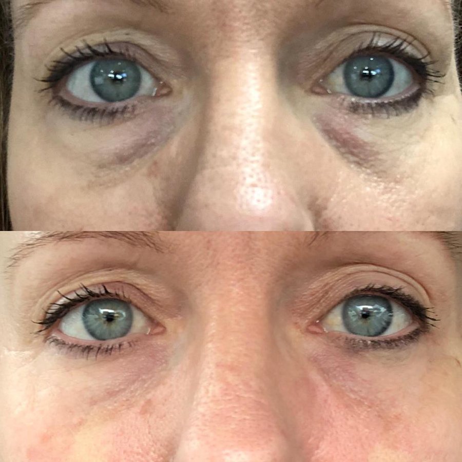 Injex Clinics - Injex Clinics