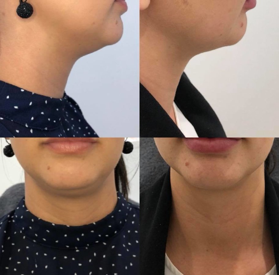 Injex Clinics - Injex Clinics