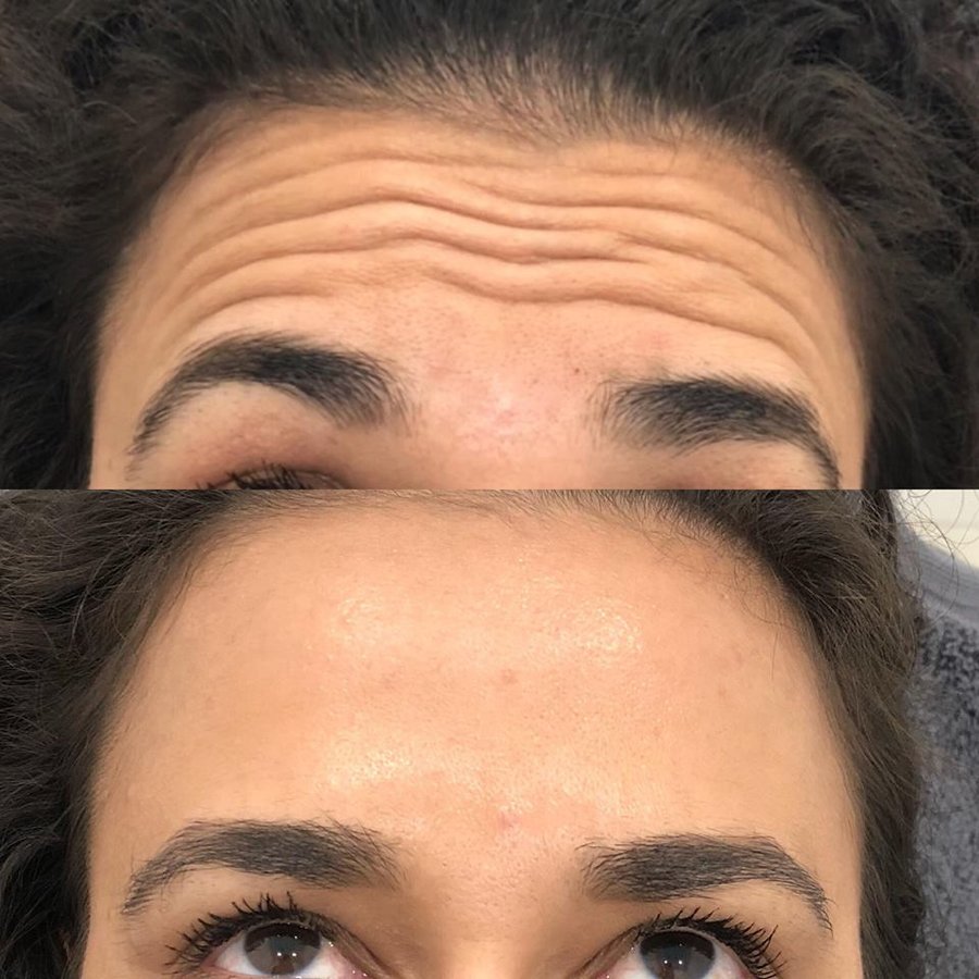 Injex Clinics - Injex Clinics