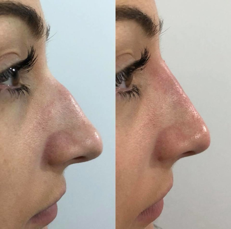 Injex Clinics - Injex Clinics