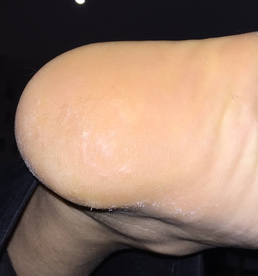 Instant Laser Clinic - Instant Laser Clinic