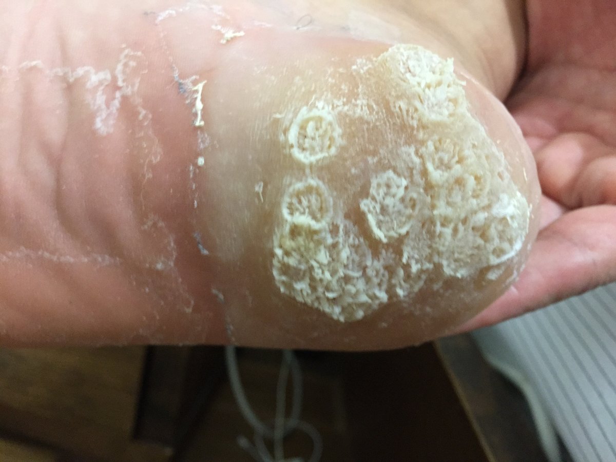 Instant Laser Clinic - Instant Laser Clinic