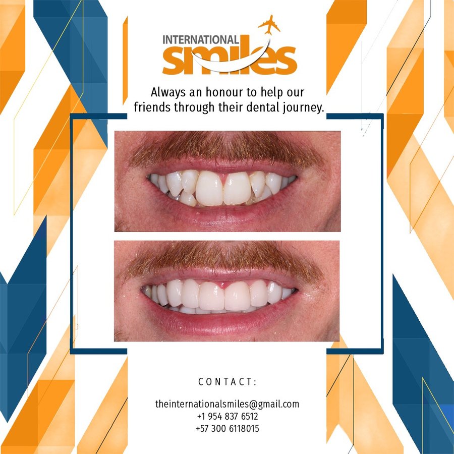 International Smiles-Adriana Castaño: DDS - International Smiles-Adriana Castaño: DDS