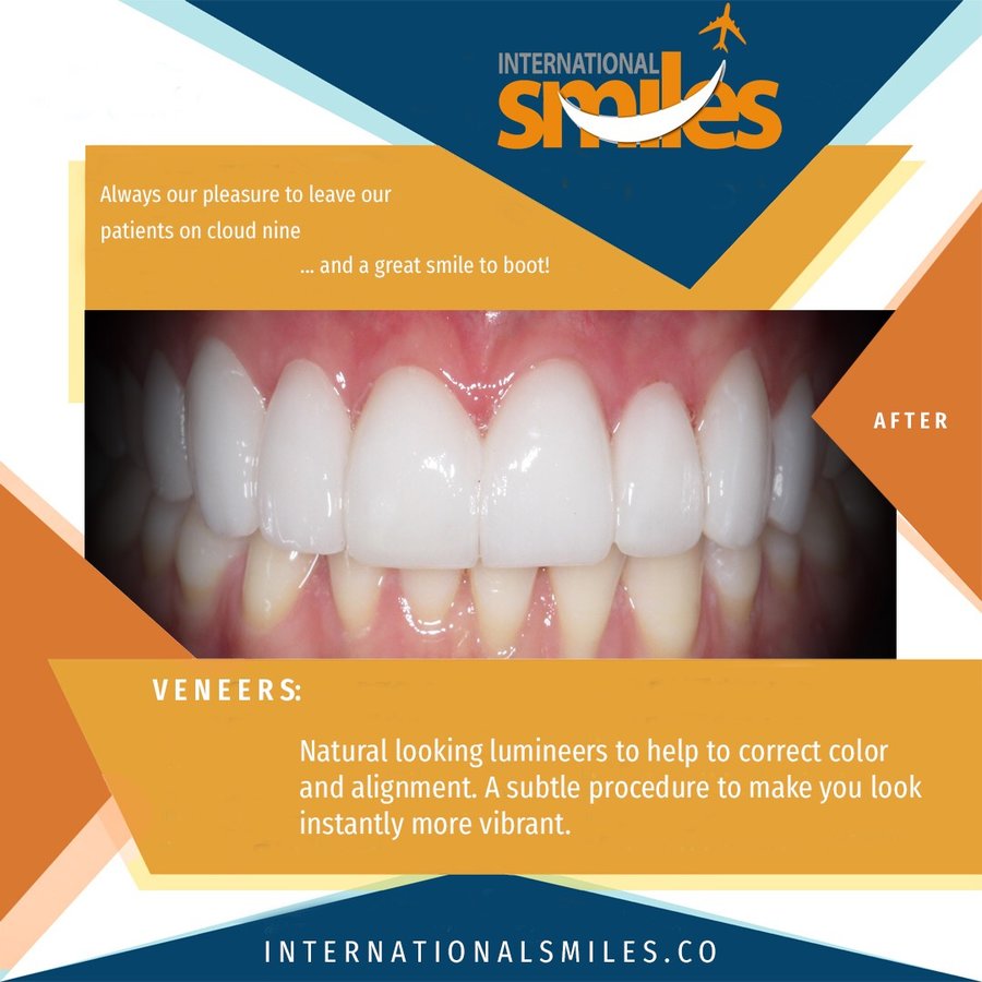 International Smiles-Adriana Castaño: DDS - International Smiles-Adriana Castaño: DDS