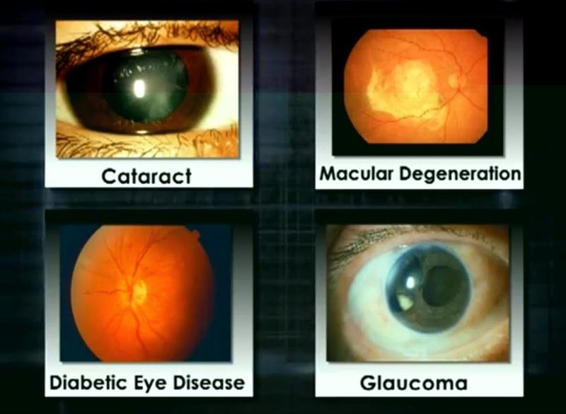 International Specialist Eye Centre - International Specialist Eye Centre
