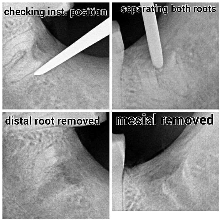 Ismail Dental Hospital and Research Center - Ismail Dental Hospital and Research Center