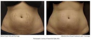 Istanbul Anti-Aging Clinic-Dr. Muñoz Paris - Istanbul Anti-Aging Clinic-Dr. Muñoz Paris