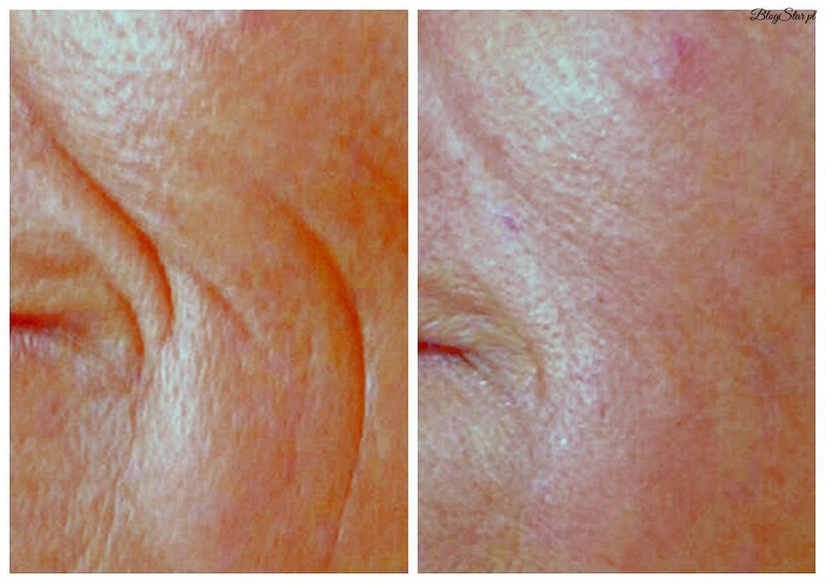 Istanbul Anti-Aging Clinic-Dr. Muñoz Paris - Istanbul Anti-Aging Clinic-Dr. Muñoz Paris