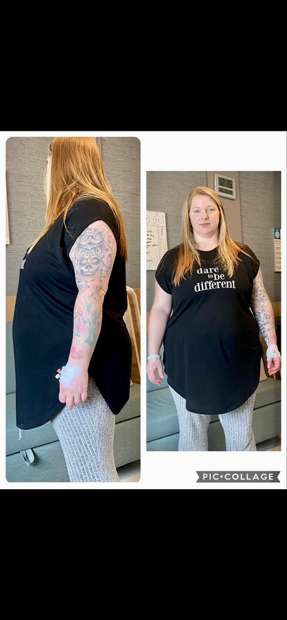 Istanbul Bariatric Center - Istanbul Bariatric Center