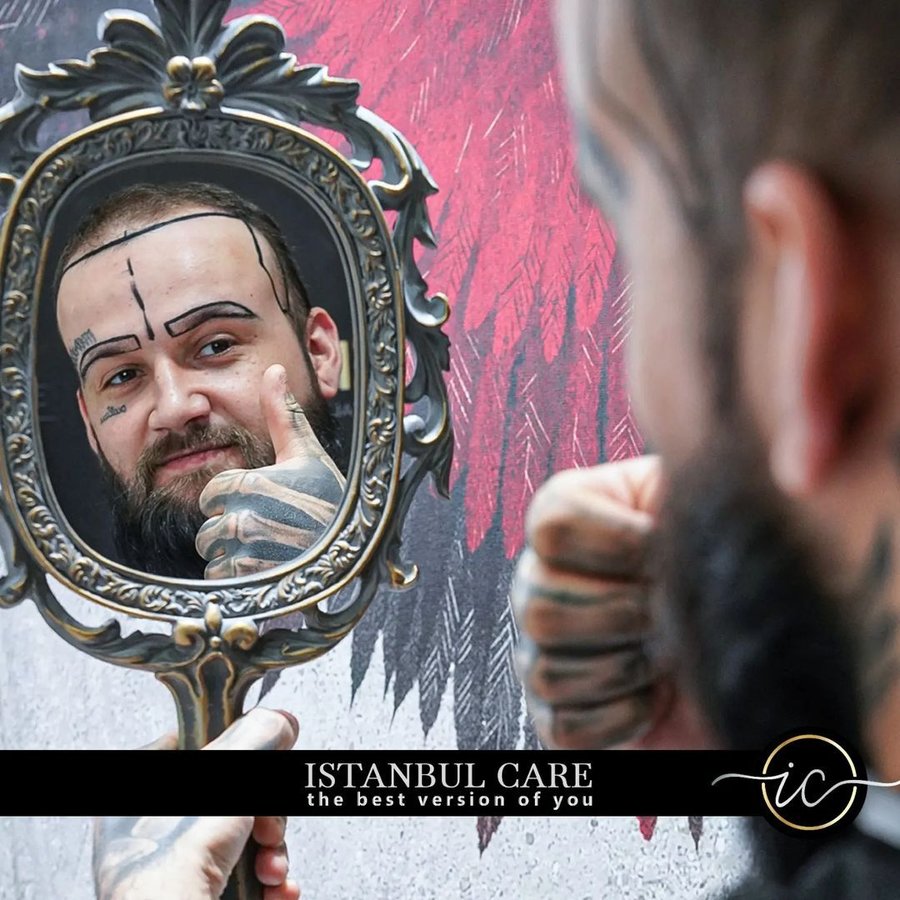 Istanbul Care, Hair Transplant In Turkey - Istanbul Care, Hair Transplant In Turkey