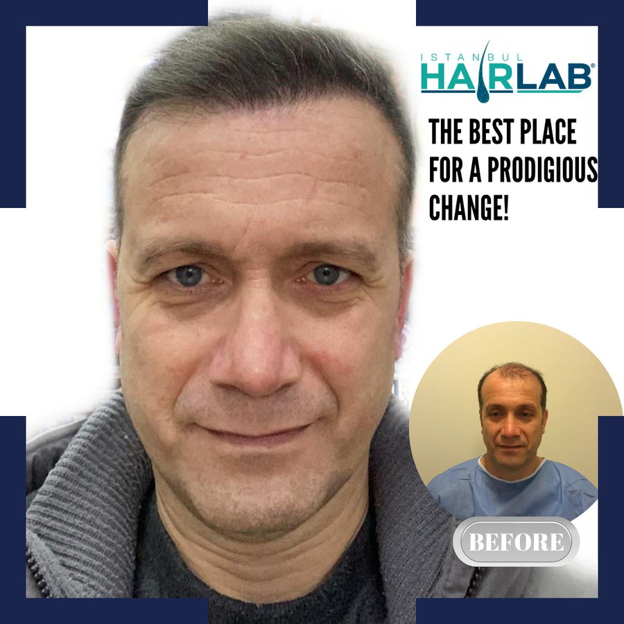 معمل اسطنبول للشعر - İstanbul Hair Lab