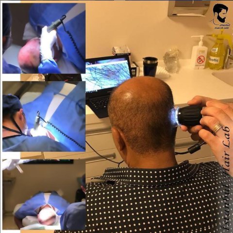 معمل اسطنبول للشعر - İstanbul Hair Lab