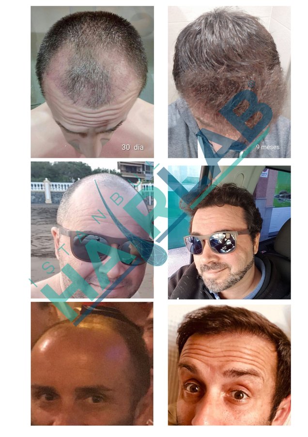 معمل اسطنبول للشعر - İstanbul Hair Lab