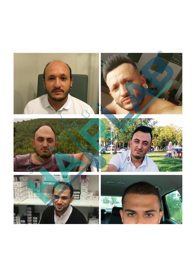 معمل اسطنبول للشعر - İstanbul Hair Lab