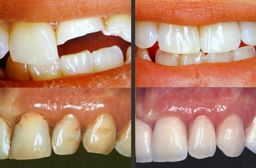 Ivories Dental Clinic & Dental Implant Clinic - Ivories Dental Clinic & Dental Implant Clinic