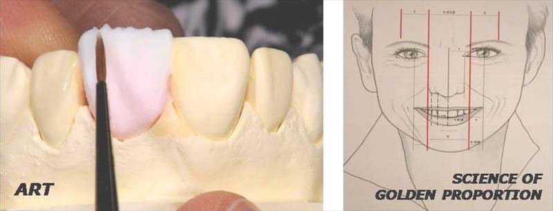 Ivories Dental Clinic & Dental Implant Clinic - Ivories Dental Clinic & Dental Implant Clinic