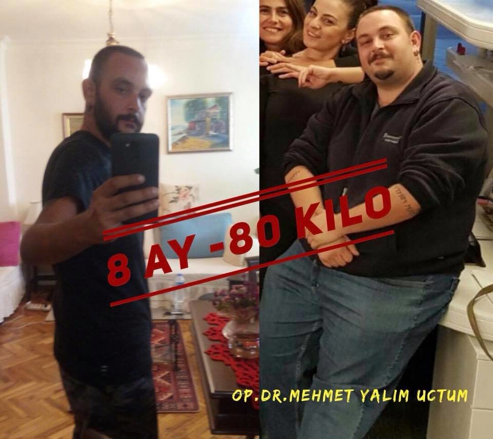 إيزميربيرياتريكس - izmirbariatrics