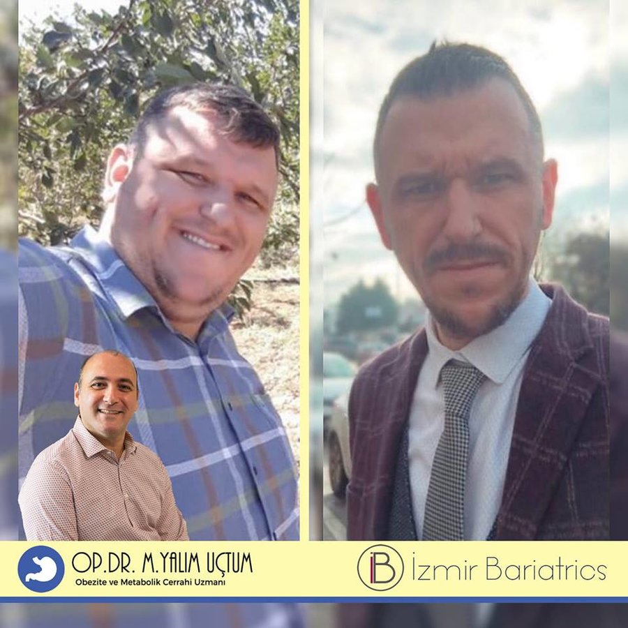 إيزميربيرياتريكس - izmirbariatrics