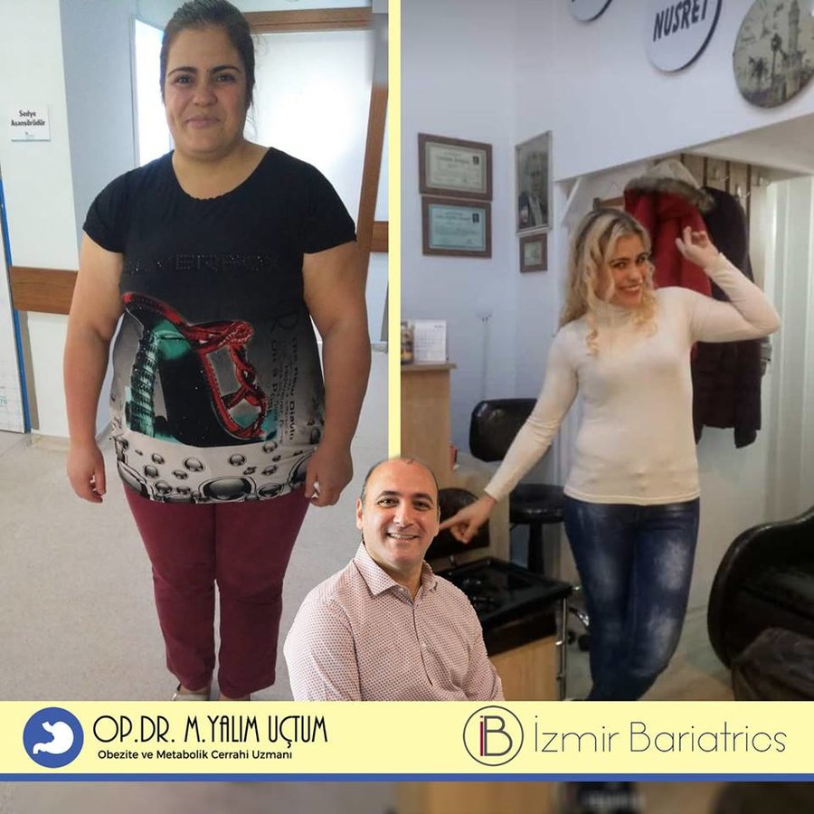 إيزميربيرياتريكس - izmirbariatrics
