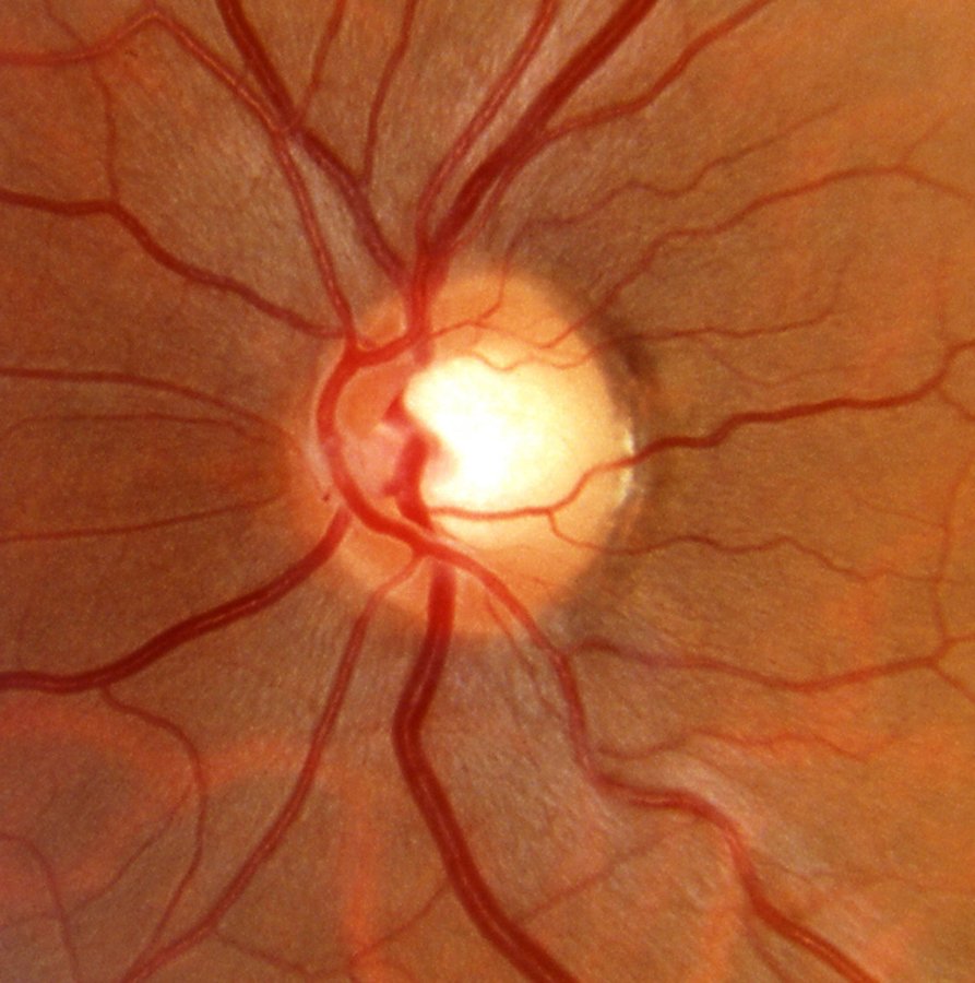 Jain Eye Clinic Hospital - Jain Eye Clinic Hospital