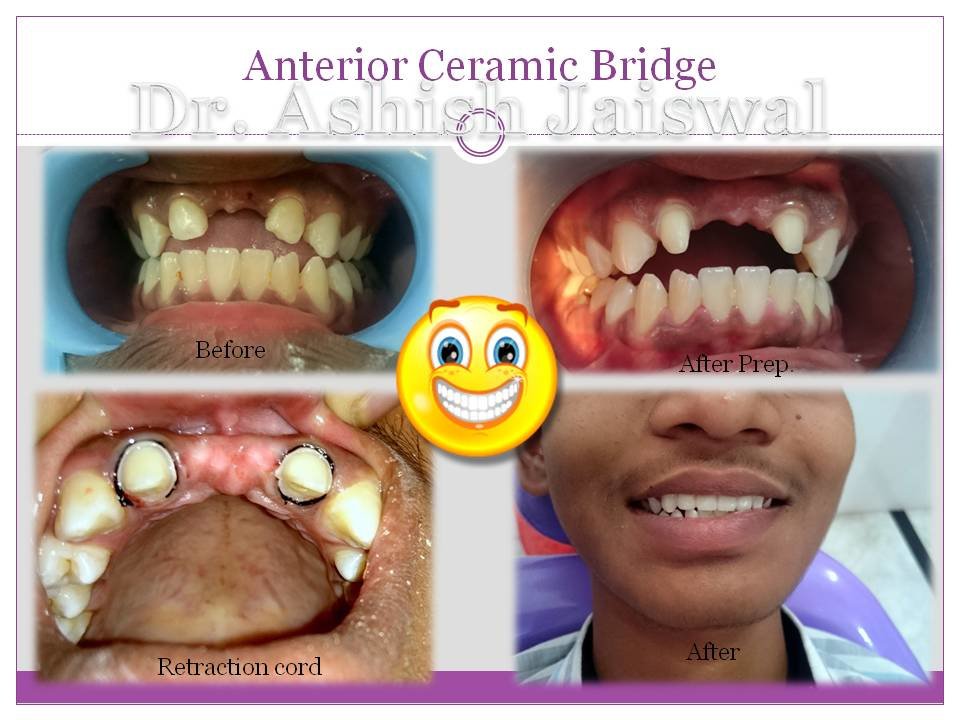 Jaiswal Dental Clinic - Jaiswal Dental Clinic