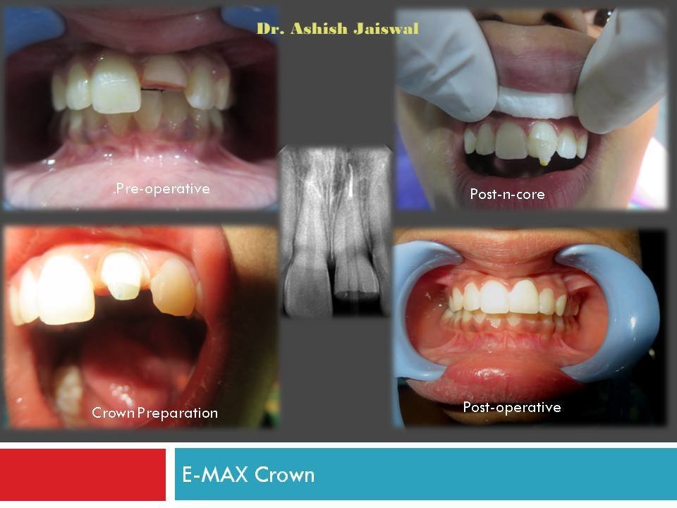 Jaiswal Dental Clinic - Jaiswal Dental Clinic