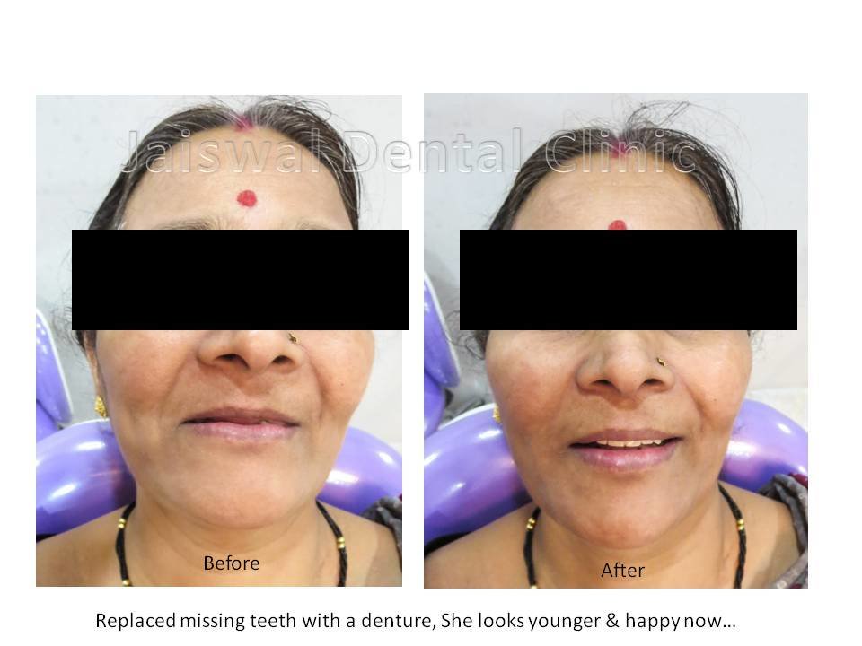 Jaiswal Dental Clinic - Jaiswal Dental Clinic