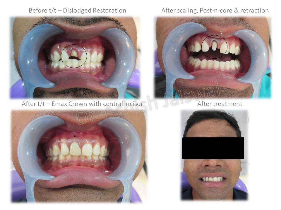 Jaiswal Dental Clinic - Jaiswal Dental Clinic