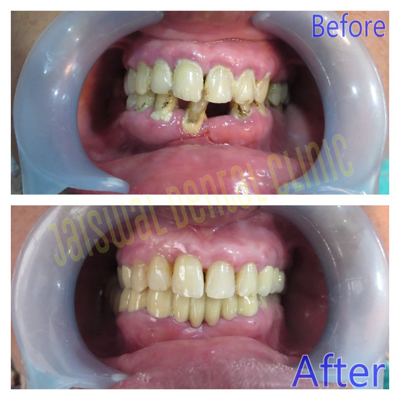 Jaiswal Dental Clinic - Jaiswal Dental Clinic