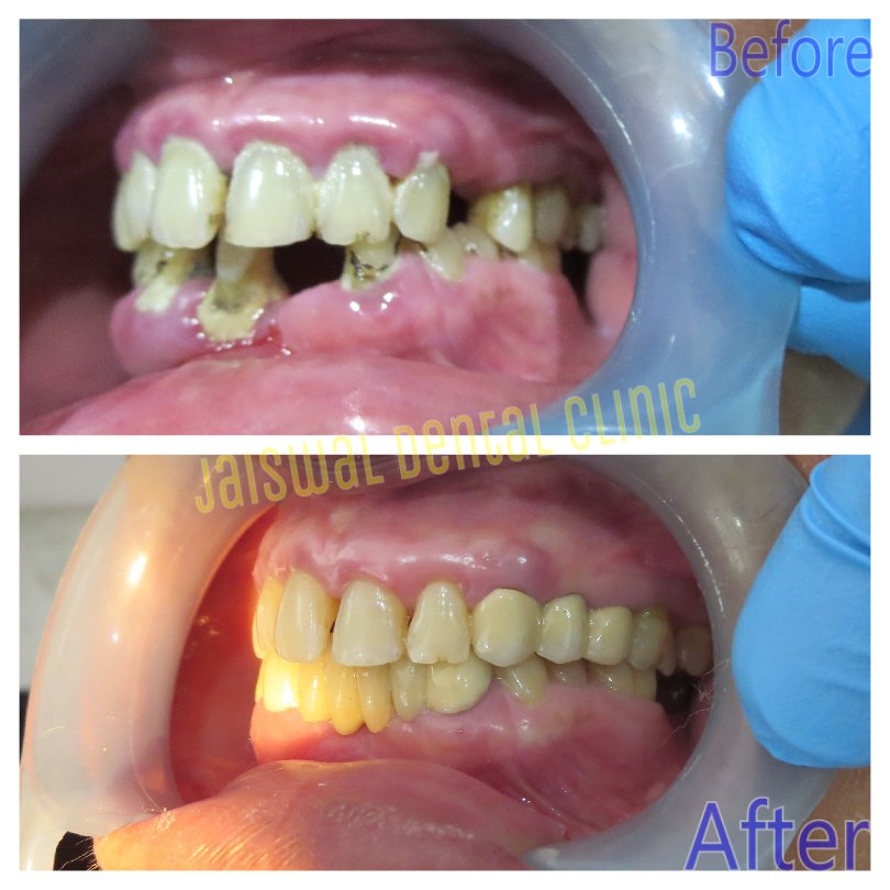 Jaiswal Dental Clinic - Jaiswal Dental Clinic