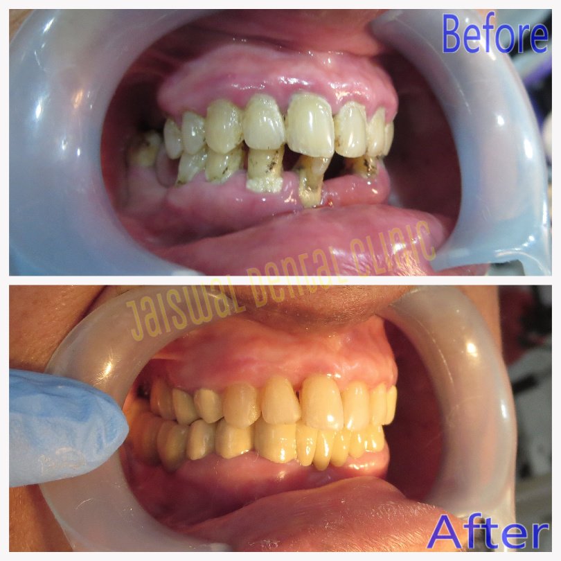 Jaiswal Dental Clinic - Jaiswal Dental Clinic