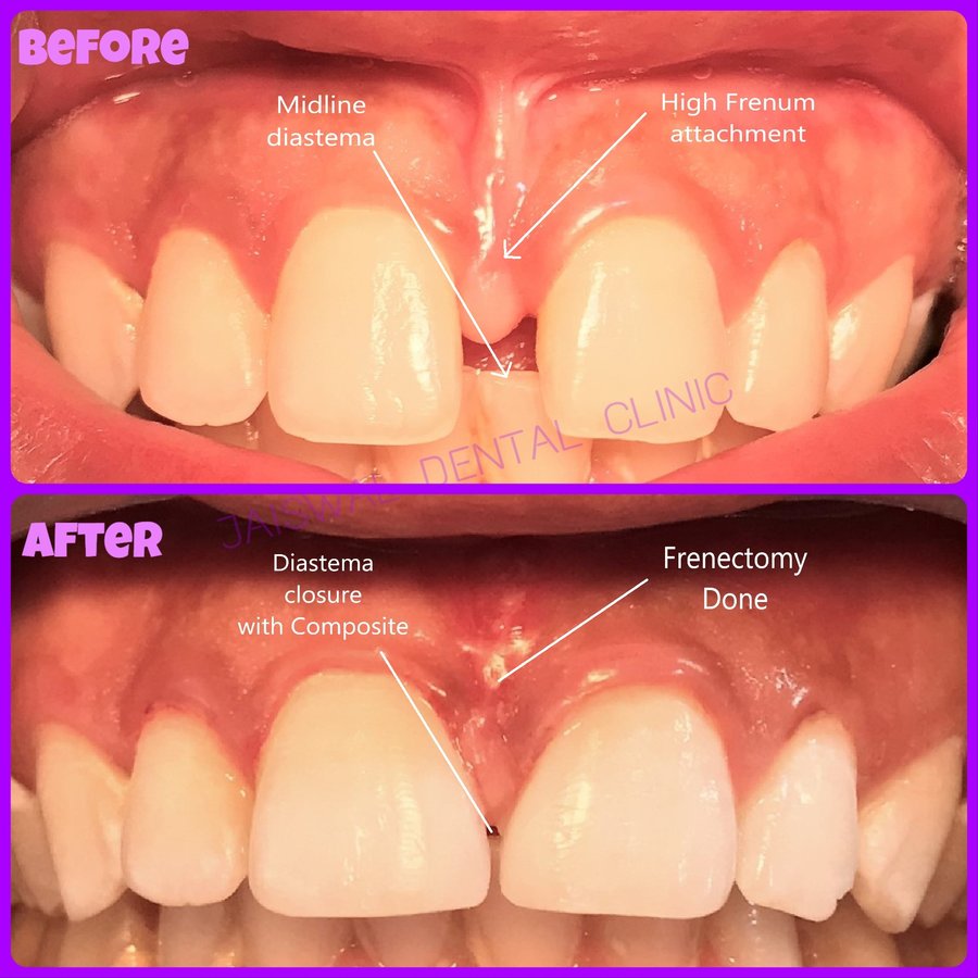 Jaiswal Dental Clinic - Jaiswal Dental Clinic