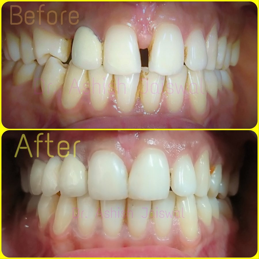 Jaiswal Dental Clinic - Jaiswal Dental Clinic