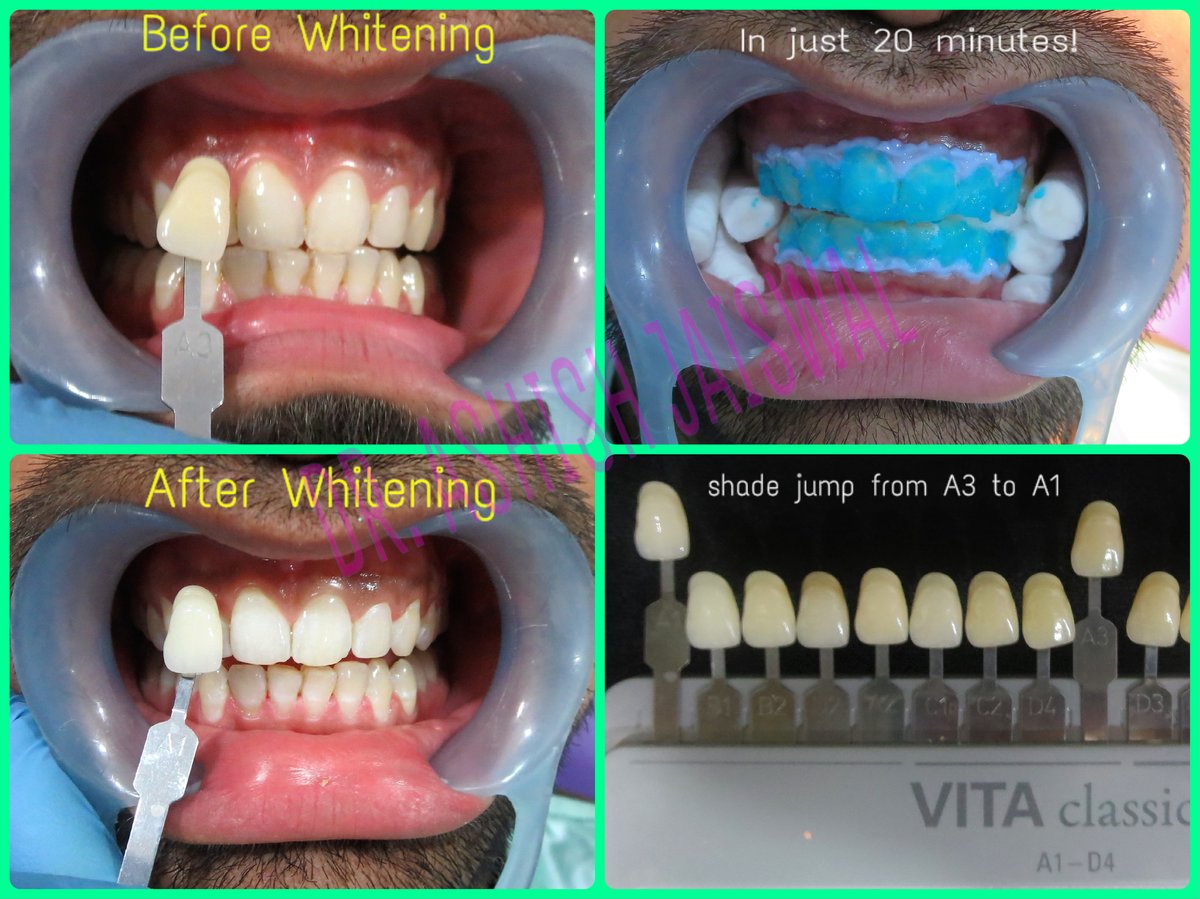 Jaiswal Dental Clinic - Jaiswal Dental Clinic