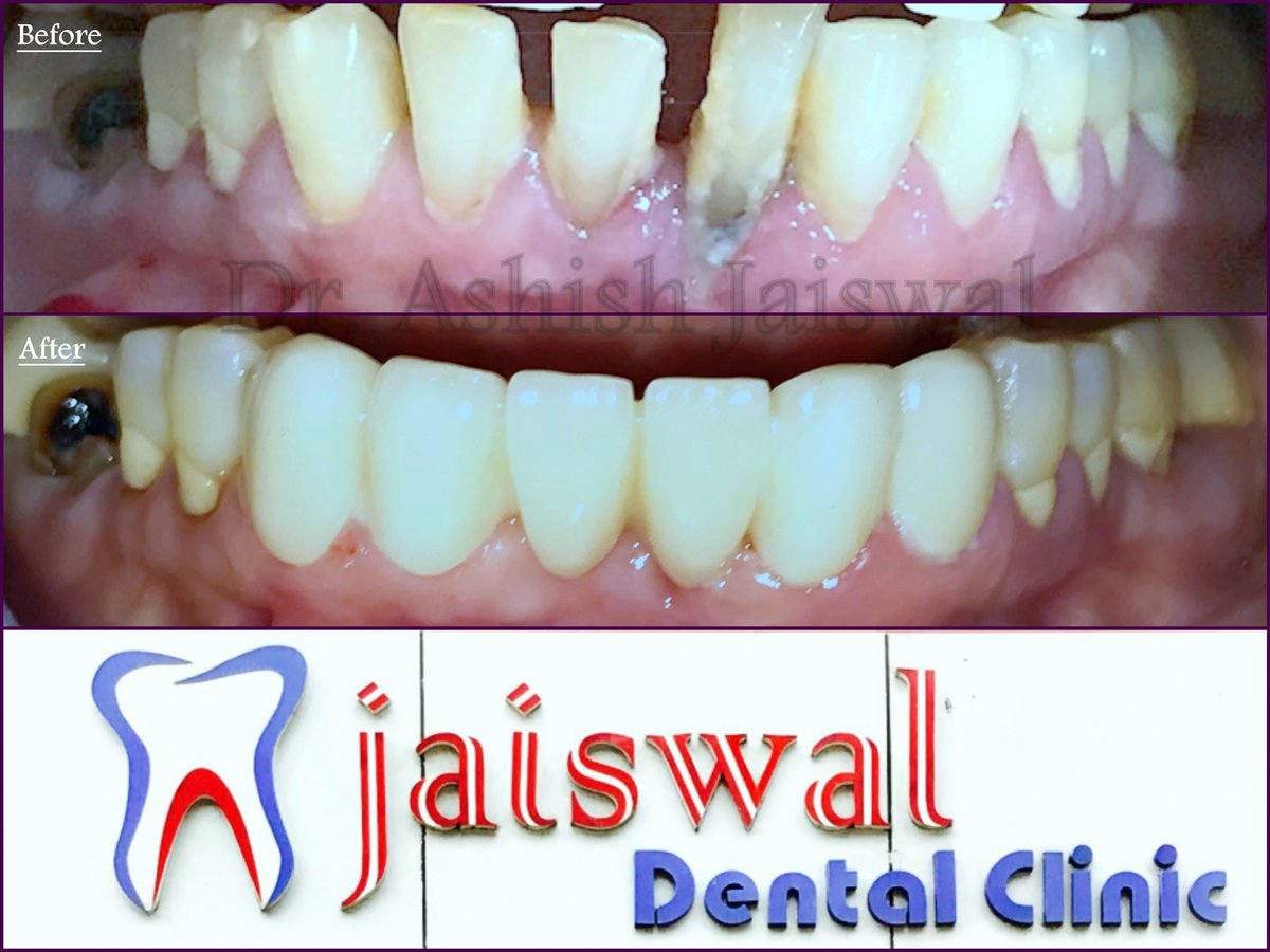 Jaiswal Dental Clinic - Jaiswal Dental Clinic
