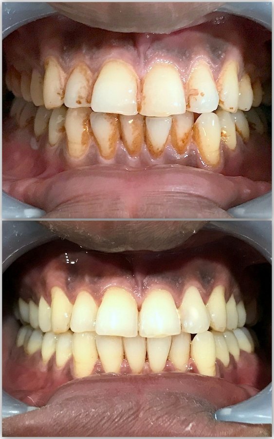 Jaiswal Dental Clinic - Jaiswal Dental Clinic