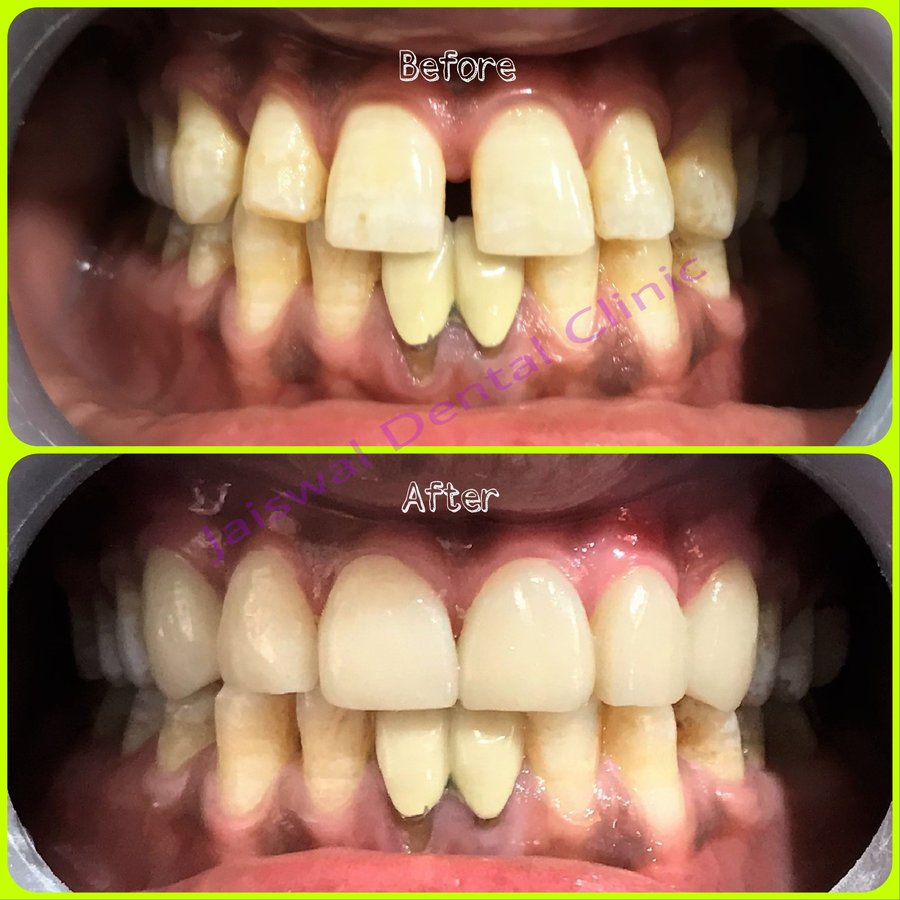 Jaiswal Dental Clinic - Jaiswal Dental Clinic