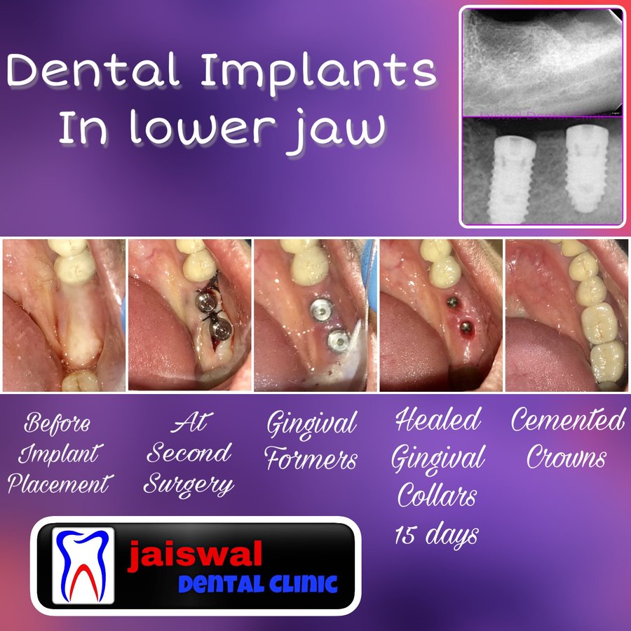 Jaiswal Dental Clinic - Jaiswal Dental Clinic