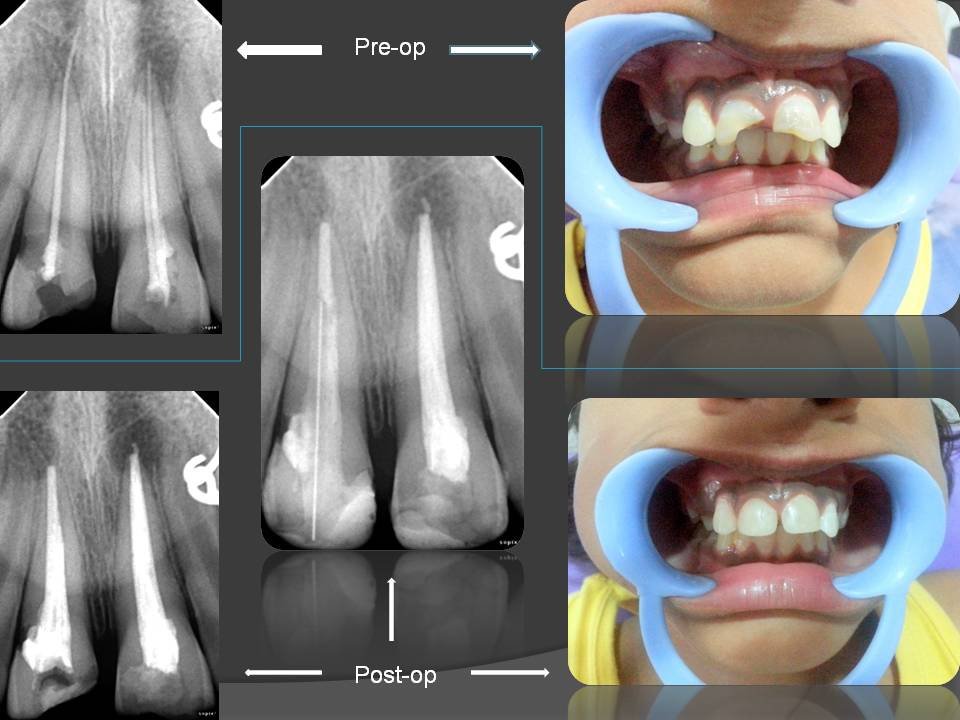 Jaiswal Dental Clinic - Jaiswal Dental Clinic