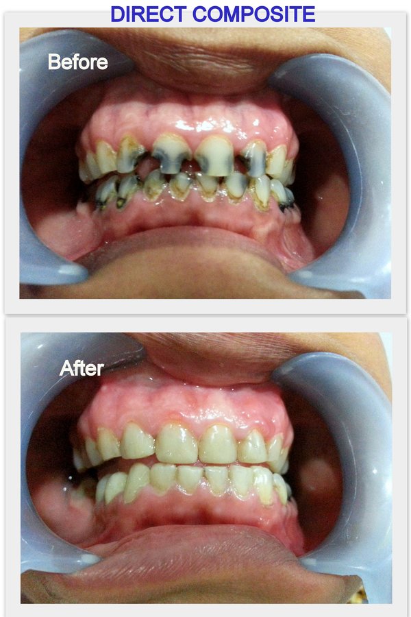 Jaiswal Dental Clinic - Jaiswal Dental Clinic