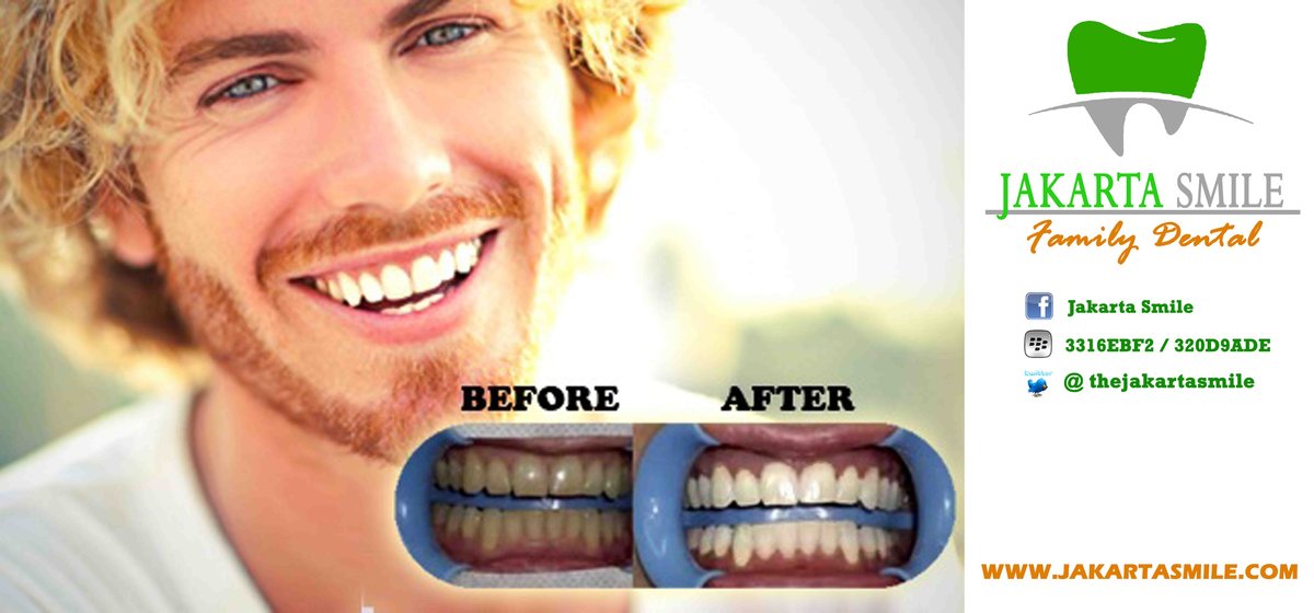 جاكرتا ابتسامة - الأسرة الأسنان-Kenmanggisan - Jakarta Smile - Family Dental-Kenmanggisan