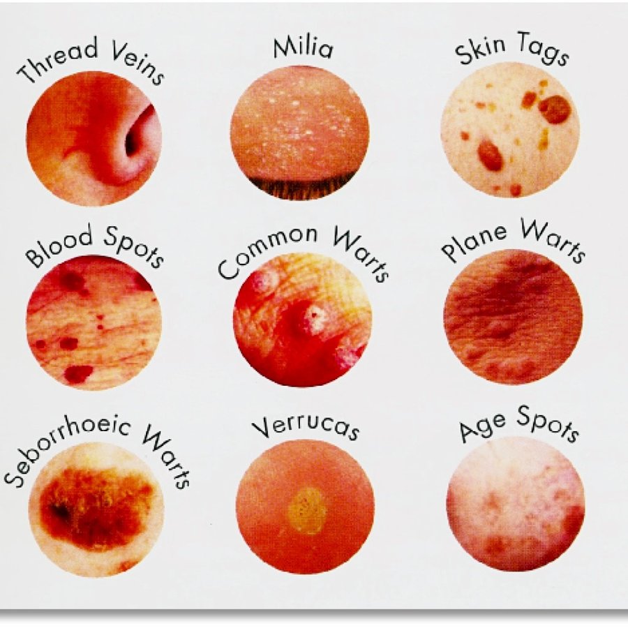 Jane Hancy Specialist in Electrolysis BIAE - Jane Hancy Specialist in Electrolysis BIAE