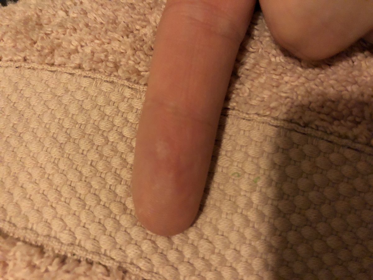 Jane Hancy Specialist in Electrolysis BIAE - Jane Hancy Specialist in Electrolysis BIAE