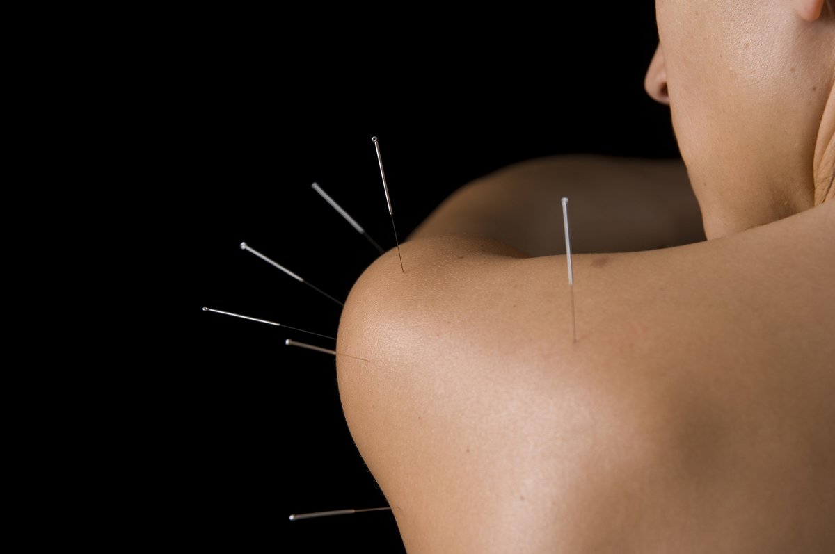 Jenny Meagor - Acupuncture - Jenny Meagor - Acupuncture