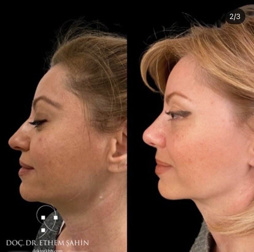 جولي بيانكا للرعاية الصحية - Jolie Bianca Health Care