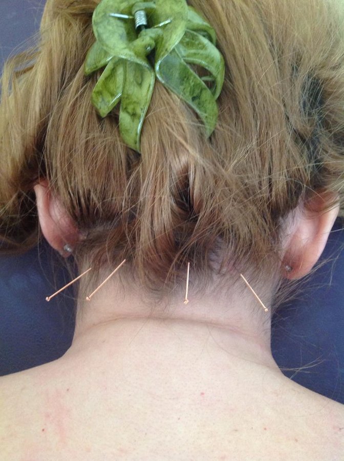 Josie Grieve Sports Therapy and Injury Management - Josie Grieve Sports Therapy and Injury Management