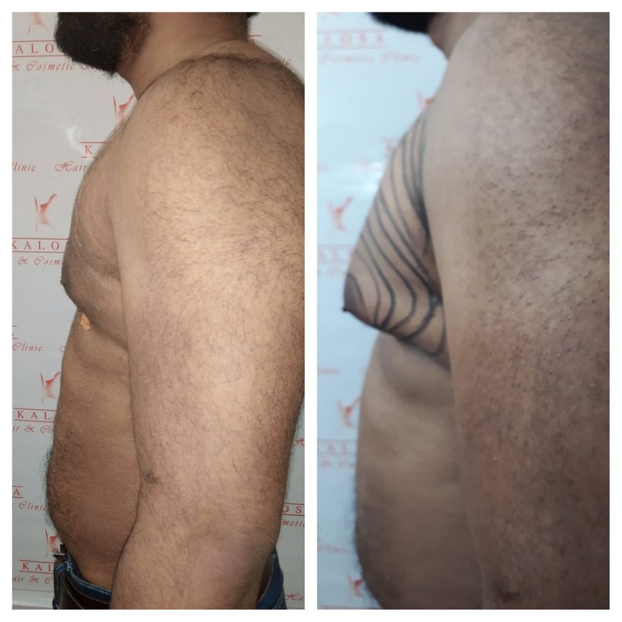 Kalosa - Hair & Cosmetic Clinic - Kalosa - Hair & Cosmetic Clinic