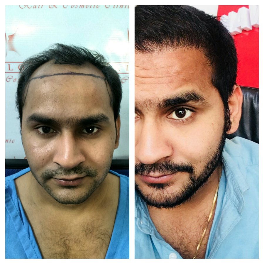 Kalosa - Hair & Cosmetic Clinic - Kalosa - Hair & Cosmetic Clinic