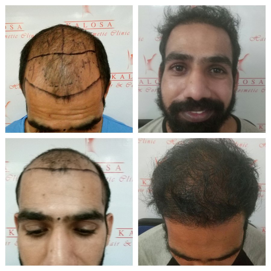 Kalosa - Hair & Cosmetic Clinic - Kalosa - Hair & Cosmetic Clinic
