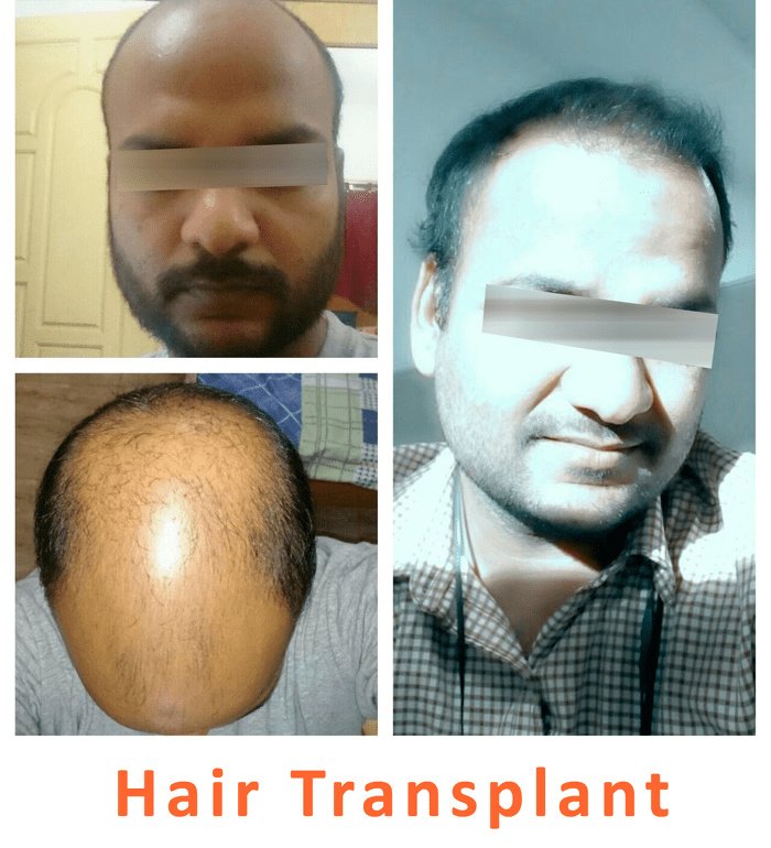Kalosa - Hair & Cosmetic Clinic - Kalosa - Hair & Cosmetic Clinic